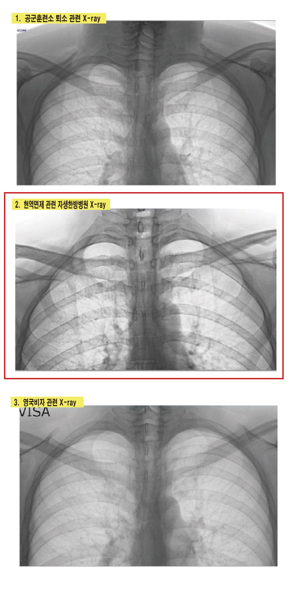 새로이 공개된 X-ray 사진 자료들